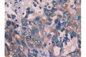 Used in DAB staining on fromalin fixed paraffin- embedded kidney tissue (ECT2 抗体  (AA 453-647))