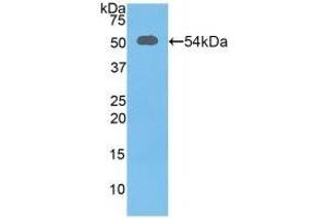 Detection of Recombinant SLC3A2, Mouse using Polyclonal Antibody to Solute Carrier Family 3, Member 2 (SLC3A2) (SLC3A2 抗体  (AA 285-521))