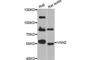 Western blot analysis of extracts of Raji and rat testis cell lines, using VNN2 antibody. (VNN2 抗体)