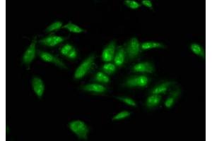 Immunofluorescence staining of Hela cells with ABIN7173496 at 1:66, counter-stained with DAPI. (NSUN2 抗体  (AA 432-509))