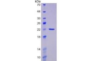 SDS-PAGE of Protein Standard from the Kit (Highly purified E. (PTGDS ELISA 试剂盒)