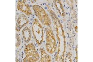 Immunohistochemistry of paraffin-embedded human kidney using NOX4 antibody at dilution of 1:200 (x400 lens) (NADPH Oxidase 4 抗体)