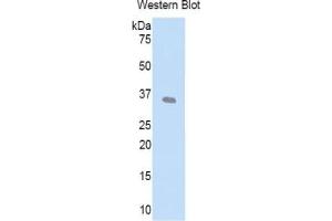 WB of Protein Standard: different control antibodies against Highly purified E. (LEFTY1 ELISA 试剂盒)