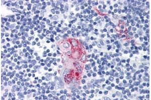 Human Thymus: Formalin-Fixed, Paraffin-Embedded (FFPE) (CD1d 抗体)