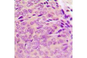 Immunohistochemistry (IHC) image for anti-Protein tyrosine Phosphatase, Non-Receptor Type 1 (PTPN1) (N-Term), (pSer50) antibody (ABIN7301176)