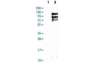 Western Blot analysis of Lane 1: negative control (vector only transfected HEK293T cell lysate) and Lane 2: over-expression lysate (co-expressed with a C-terminal myc-DDK tag in mammalian HEK293T cells) with TPX2 polyclonal antibody . (TPX2 抗体)