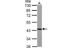 WB Image ACADM antibody detects ACADM protein by Western blot analysis. (Medium-Chain Specific Acyl-CoA Dehydrogenase, Mitochondrial (Center) 抗体)