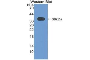 Detection of Recombinant KNT1, Rat using Polyclonal Antibody to T-Kininogen 1 (KNT1) (KNG1 抗体  (AA 367-430))