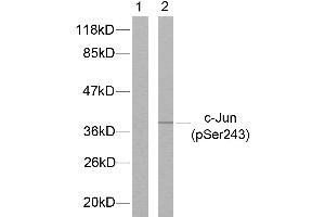 Western blot analysis of extracts from HeLa cells treated with UV, using c-Jun (phospho-Ser243) antibody. (C-JUN 抗体  (pSer243))