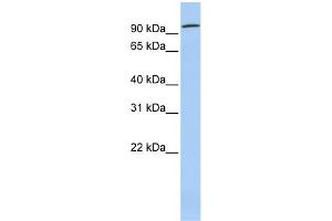WB Suggested Anti-ZNF777 Antibody Titration:  0. (ZNF777 抗体  (Middle Region))