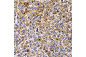 Immunohistochemistry of paraffin-embedded mouse cancer using UBE2R2 antibody (ABIN5975512) at dilution of 1/100 (40x lens). (UBE2R2 抗体)