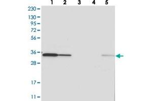 Western blot analysis of Lane 1: RT-4, Lane 2: U-251 MG, Lane 3: Human Plasma, Lane 4: Liver, Lane 5: Tonsil with C1orf74 polyclonal antibody  at 1:250-1:500 dilution. (C1ORF74 抗体)