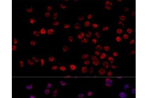 Immunofluorescence analysis of 293T cells using HNRNPH1 Polyclonal Antibody at dilution of 1:100 (40x lens). (HNRNPH1 抗体)