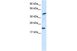 WB Suggested Anti-ZNFN1A5 Antibody Titration: 0.