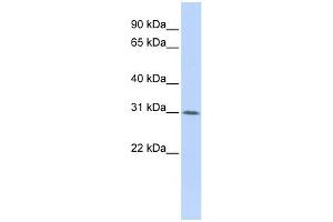 WB Suggested Anti-WDR33 Antibody Titration:  0. (WDR33 抗体  (Middle Region))