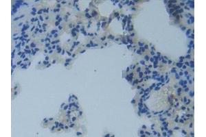 Immunohistochemistry (IHC) image for anti-Matrix Metallopeptidase 14 (Membrane-inserted) (MMP14) (AA 121-487) antibody (ABIN7434626)