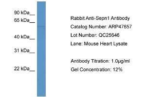 Western Blotting (WB) image for anti-Selenoprotein N, 1 (SEPN1) (C-Term) antibody (ABIN2783071) (SEPN1 抗体  (C-Term))