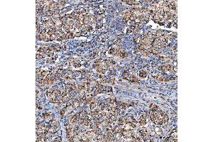 IHC analysis of SCO1 using anti-SCO1 antibody (ABIN7600609).