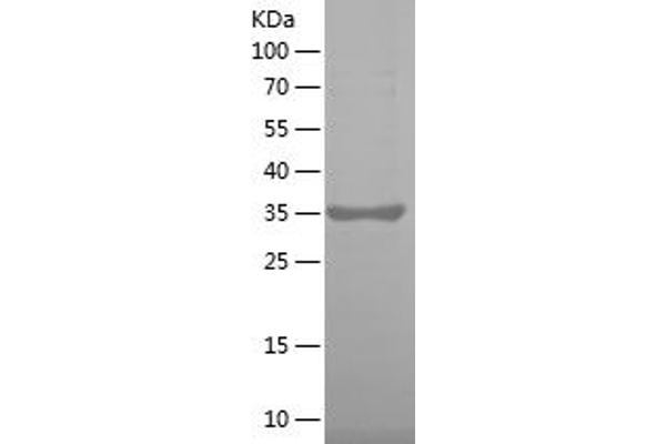 F2RL1 Protein (AA 348-397) (His-IF2DI Tag)