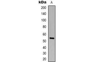 Western blot analysis of TIGD3 expression in Jurkat (A) whole cell lysates. (TIGD3 抗体  (C-Term))