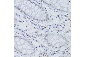 Immunohistochemistry of paraffin-embedded human colon using SNRNP70 antibody. (SNRNP70 抗体  (AA 150-250))