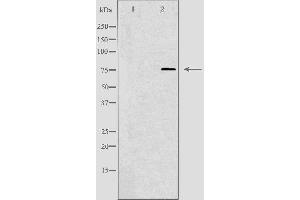 Western blot analysis of extracts from HuvEc cells, using KAL1 antibody. (Anosmin 抗体  (Internal Region))