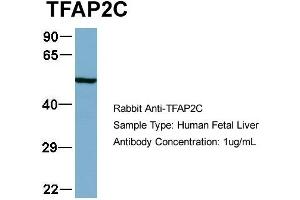 Western Blotting (WB) image for anti-Transcription Factor AP-2 gamma (Activating Enhancer Binding Protein 2 Gamma) (TFAP2C) (N-Term) antibody (ABIN2780497)
