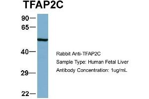 Host:  Rabbit  Target Name:  TFAP2C  Sample Type:  Human Fetal Liver  Antibody Dilution:  1. (TFAP2C 抗体  (N-Term))