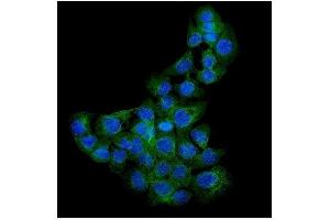 IF analysis of Syndecan-1 using anti-Syndecan-1 antibody (ABIN3043430). (Syndecan 1 抗体  (C-Term))