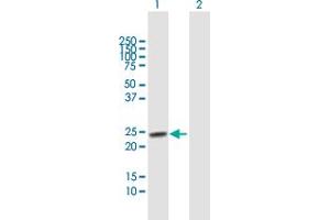 Western Blot analysis of TSPYL4 expression in transfected 293T cell line by TSPYL4 MaxPab polyclonal antibody. (TSPY-Like 4 抗体  (AA 1-211))