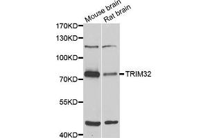 Western blot analysis of extracts of various cell lines, using TRIM32 antibody (ABIN5975475) at 1/1000 dilution. (TRIM32 抗体)