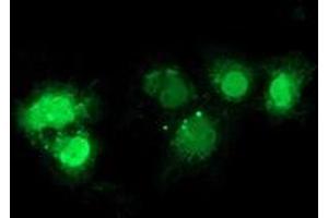 Anti-NHEJ1 mouse monoclonal antibody (ABIN2453927) immunofluorescent staining of COS7 cells transiently transfected by pCMV6-ENTRY NHEJ1 (RC203393). (NHEJ1 抗体)