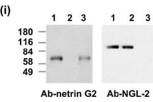 Adult mouse brain immunoblot: extracts of brains from wild-type (1), Netrin-G2 knockout (2) and NGL-2 knockout (3) mice were probed with Netrin-G2 antibody (left) or N50/36 (right). (LRRC4 抗体  (AA 550-652))