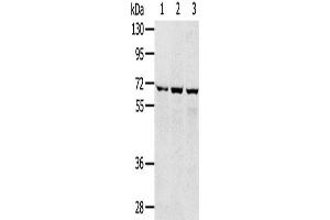 Western Blotting (WB) image for anti-Solute Carrier Family 5 (Sodium/glucose Cotransporter), Member 9 (SLC5A9) antibody (ABIN2427251) (SLC5A9 抗体)