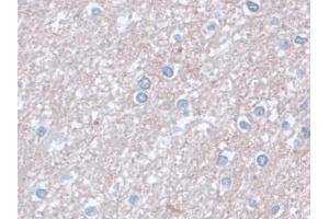 Immunohistochemistry (IHC) image for anti-Glutamic-Oxaloacetic Transaminase 1, Soluble (Aspartate Aminotransferase 1) (GOT1) (AA 1-413) antibody (ABIN7426220)
