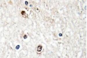 Image no. 1 for anti-NGFI-A Binding Protein 2 (EGR1 Binding Protein 2) (NAB2) antibody (ABIN317614) (NAB2 抗体)