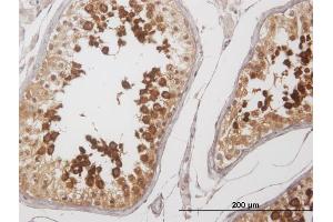 Immunoperoxidase of purified MaxPab antibody to YBX2 on formalin-fixed paraffin-embedded human testis. (YBX2 抗体  (AA 1-364))