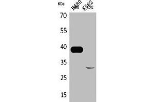Western Blot analysis of H460 K562 cells using Cathepsin L Polyclonal Antibody (Cathepsin L 抗体  (Internal Region))