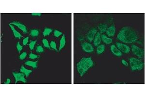 ABIN570717 (2µg/ml) staining of methanol-fixed HeLa before (left) and after (right) introduction of siRNA. (Spartin (SPART) (Internal Region) 抗体)
