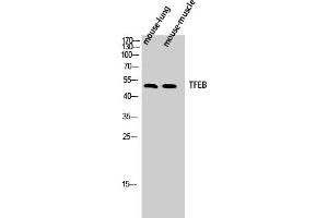 Western Blot analysis of Mouse-lung Mouse-muscle cells using TFEB Polyclonal Antibody diluted at 1:500. (TFEB 抗体  (AA 10-90))