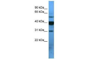 OR2T1 antibody used at 0. (OR2T1 抗体  (C-Term))