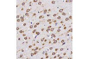 Immunohistochemistry (Paraffin-embedded Sections) (IHC (p)) image for anti-Neurotensin (NTS) antibody (ABIN7074827)