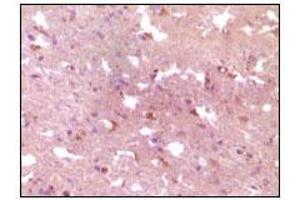 Immunohistochemical analysis of paraffin-embedded human Alzheimer brain tissue, showing cytoplasmic localization using APP mouse mAb with DAB staining. (APP 抗体)