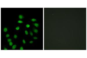 Immunofluorescence analysis of HepG2 cells, using SCAND1 antibody. (SCAND1 抗体  (Internal Region))