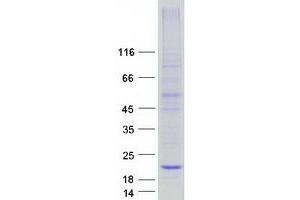 Validation with Western Blot (C20orf141 Protein (Myc-DYKDDDDK Tag))