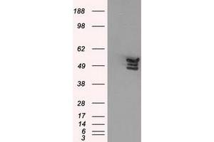 Western Blotting (WB) image for anti-Annexin A11 (ANXA11) antibody (ABIN1496647) (Annexin A11 抗体)