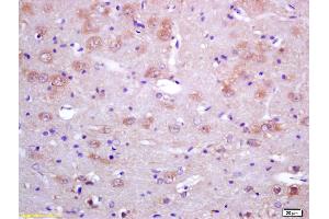 Formalin-fixed and paraffin embedded rat brain tissue labeled with RABBIT ANTI-SAHH POLYCLONAL ANTIBODY, Unconjugated (ABIN708611) at 1:200 followed by conjugation to the secondary antibody and DAB staining. (AHCY 抗体  (AA 25-125))