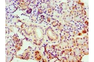 Immunohistochemistry of paraffin-embedded human pancreatic tissue using ABIN7143157 at dilution of 1:100 (ASCC3 抗体  (AA 1-111))
