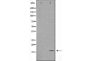 Western blot analysis of TOMM20 expression in K562 cells,The lane on the left is treated with the antigen-specific peptide. (TOMM20 抗体  (Internal Region))