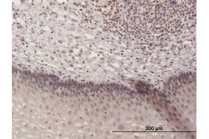 Immunoperoxidase of purified MaxPab antibody to TH1L on formalin-fixed paraffin-embedded human esophagus. (TH1-Like 抗体  (AA 1-590))